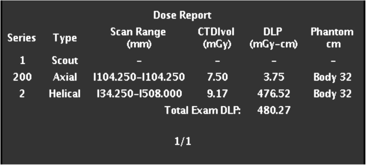 Analysis Of Effective Dose At Computed Tomography In A Modern Slice