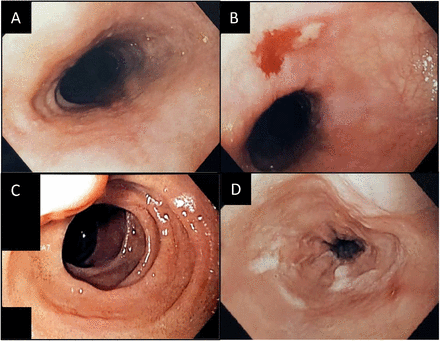 Fig. 3.