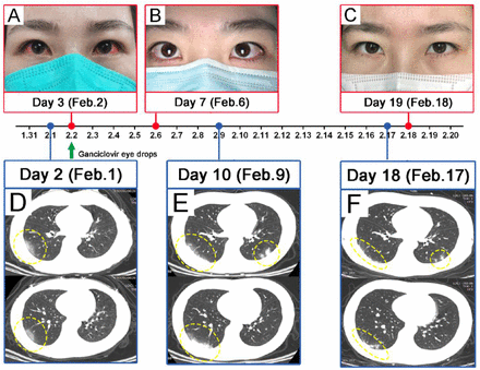 Fig. 3