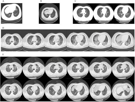 Figure 2: