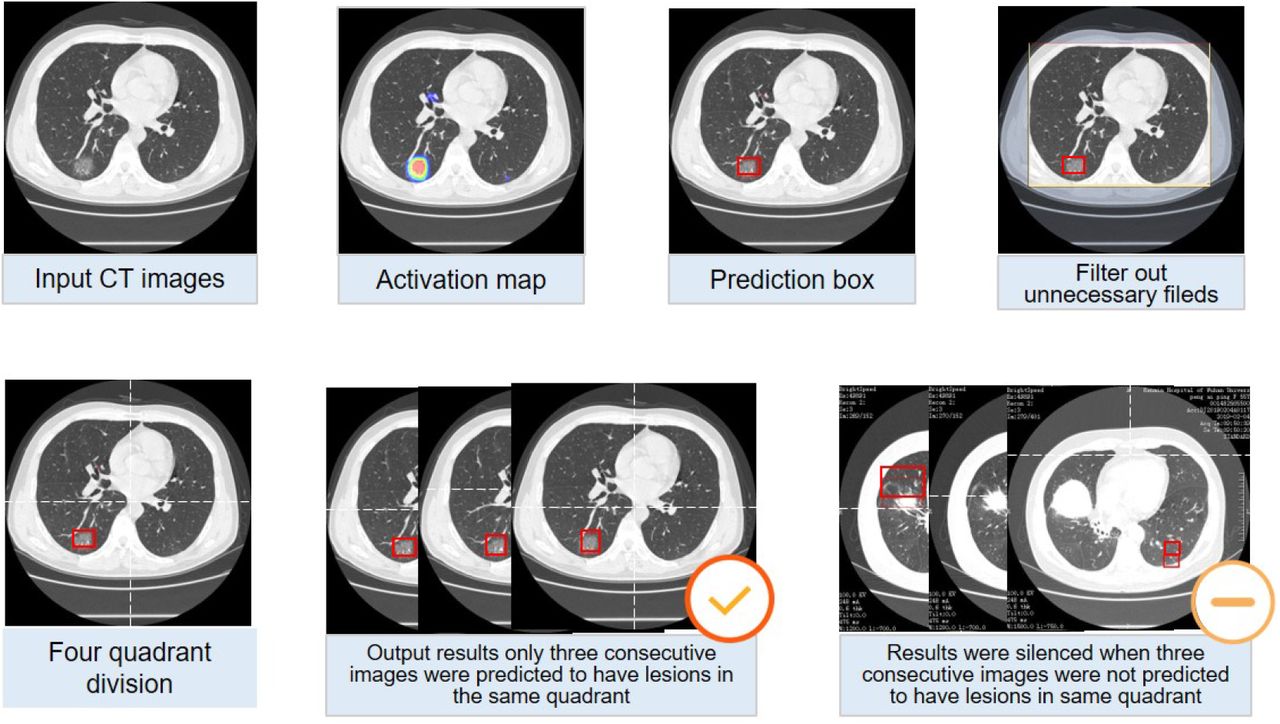 Deep learning based model for detecting 2019 novel coronavirus