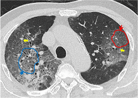 Figure 3.