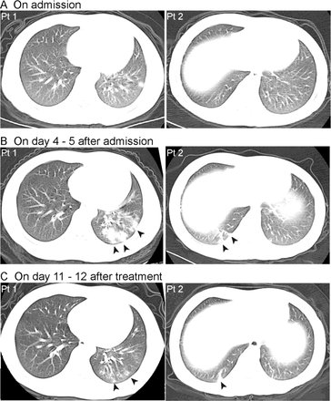 Fig 2.