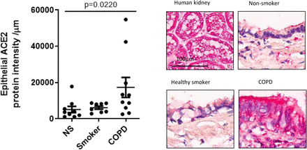 Figure 1D.