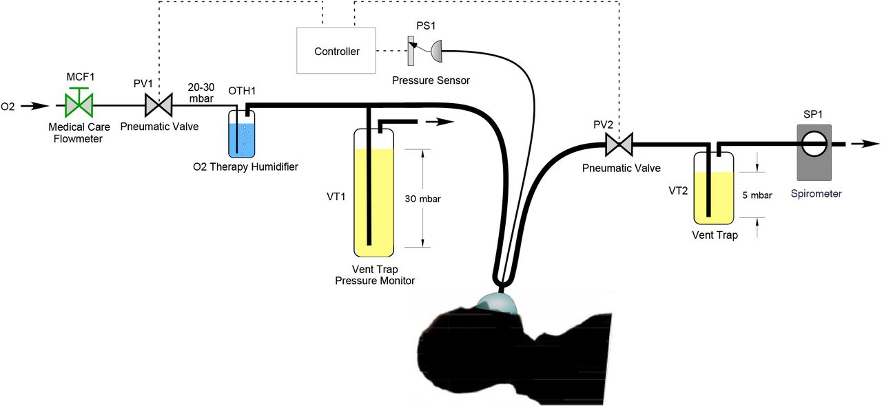 Mechanical Milano (MVM): A Mechanical Ventilator Designed for Mass Scale Production in Response to the COVID-19 Pandemics | medRxiv