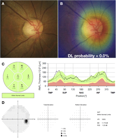 Figure 3: