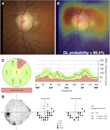 Figure 4: