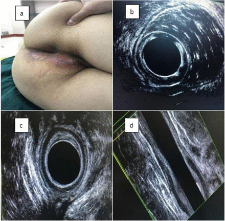 FIGURE 2.