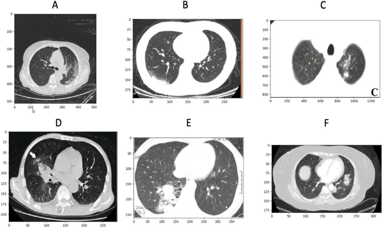 Deep learning-based segmentation of the thorax in mouse micro-CT scans