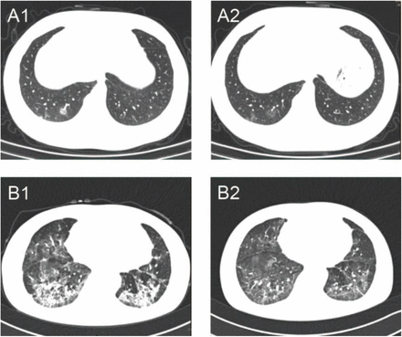 Figure 1: