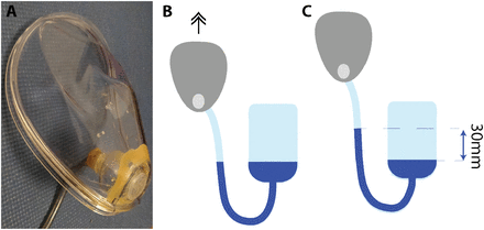 Figure 17