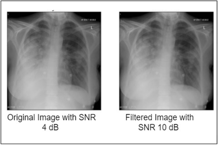 Fig-4: