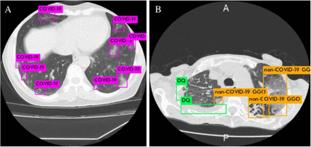 Figure 2: