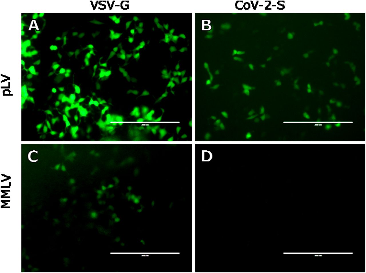 Effective Screening Of Sars Cov 2 Neutralizing Antibodies In Patient Serum Using Lentivirus Particles Pseudotyped With Sars Cov 2 Spike Glycoprotein Medrxiv