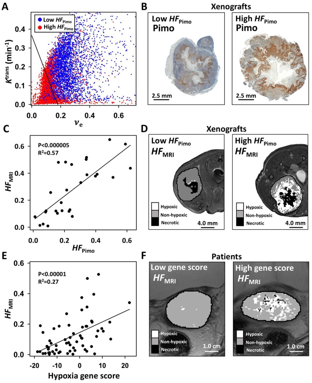 Mr Imaging Distinguishes Tumor Hypoxia Levels Of Different Prognostic And Biological Significance In Cervical Cancer Medrxiv