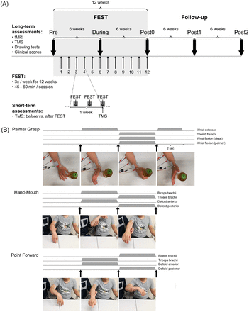 Frontiers  Intensity and Dose of Neuromuscular Electrical Stimulation  Influence Sensorimotor Cortical Excitability