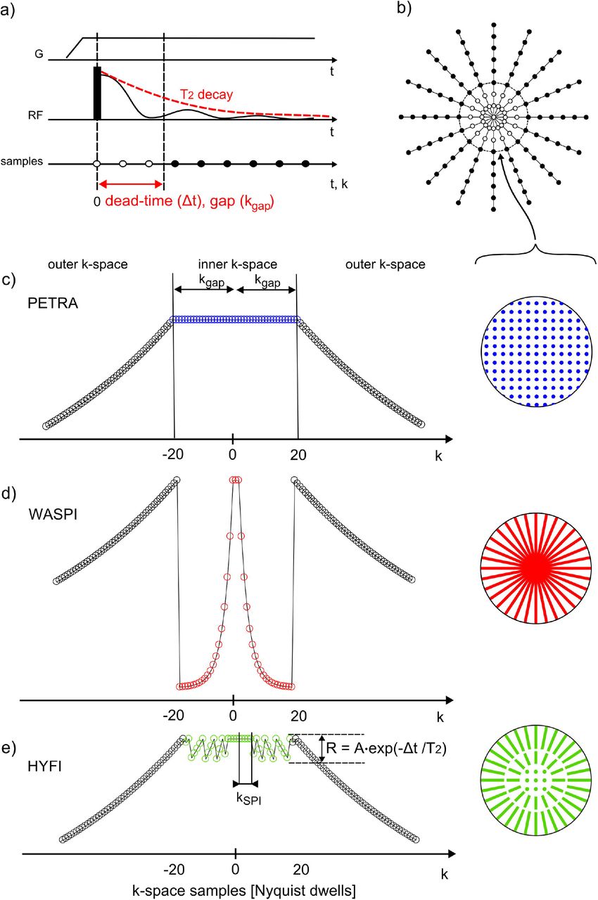 Hyfi Hybrid Filling Of The Dead Time Gap For Faster Zero Echo Time Imaging Medrxiv