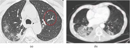 Figure 3: