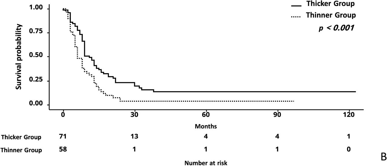 Association Between Temporal Muscle Thickness And Clinical Outes In Patients With Newly Diagnosed Glioblastoma Medrxiv