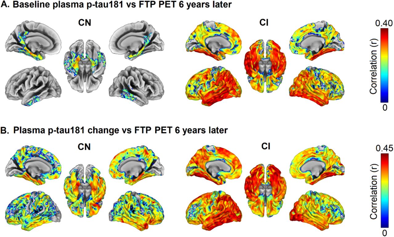 Time course of phosphorylated tau181 in blood across the Alzheimers disease spectrum medRxiv