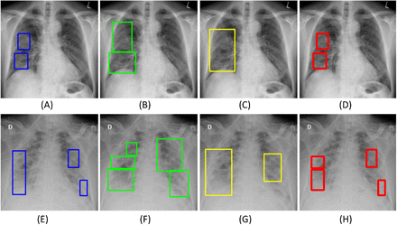 Fig 17.