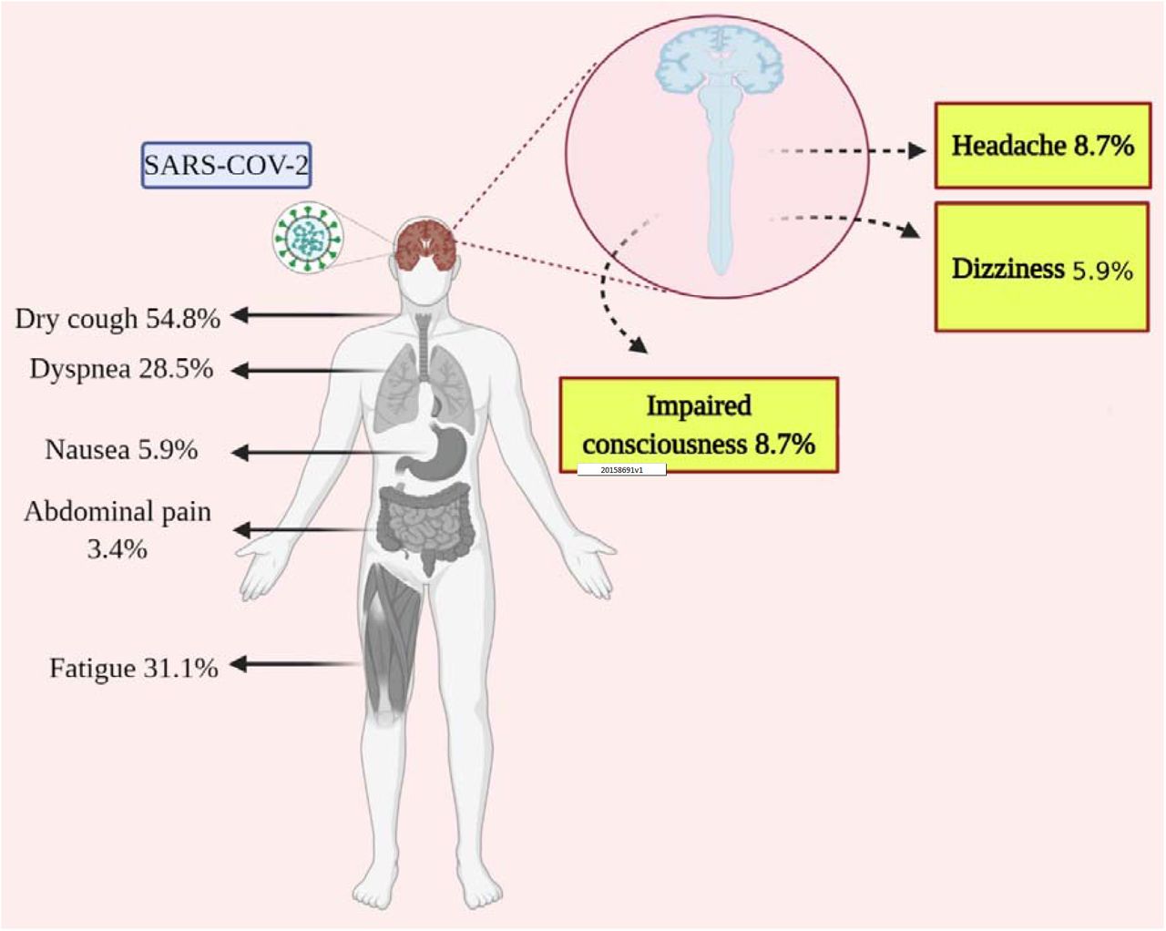 Central Nervous System Manifestations In COVID-19 Patients: A ...