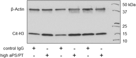 Supplementary Figure 11: