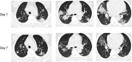 Figure 2: