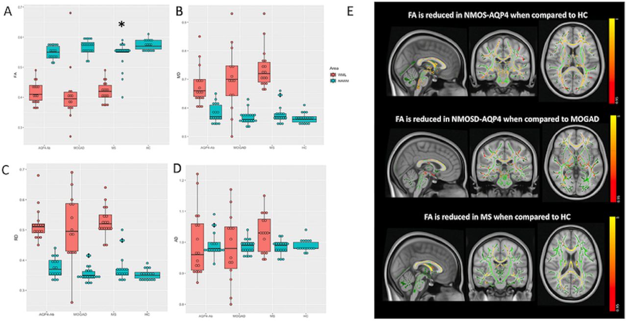 Imaging Surrogates of Disease Activity in Neuromyelitis Optica Allow  Distinction from Multiple Sclerosis