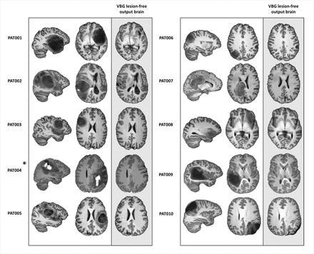 Figure 3: