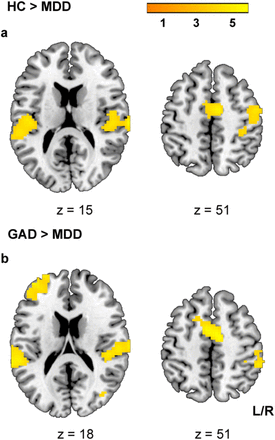 Fig.4.