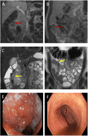 Figure 2: