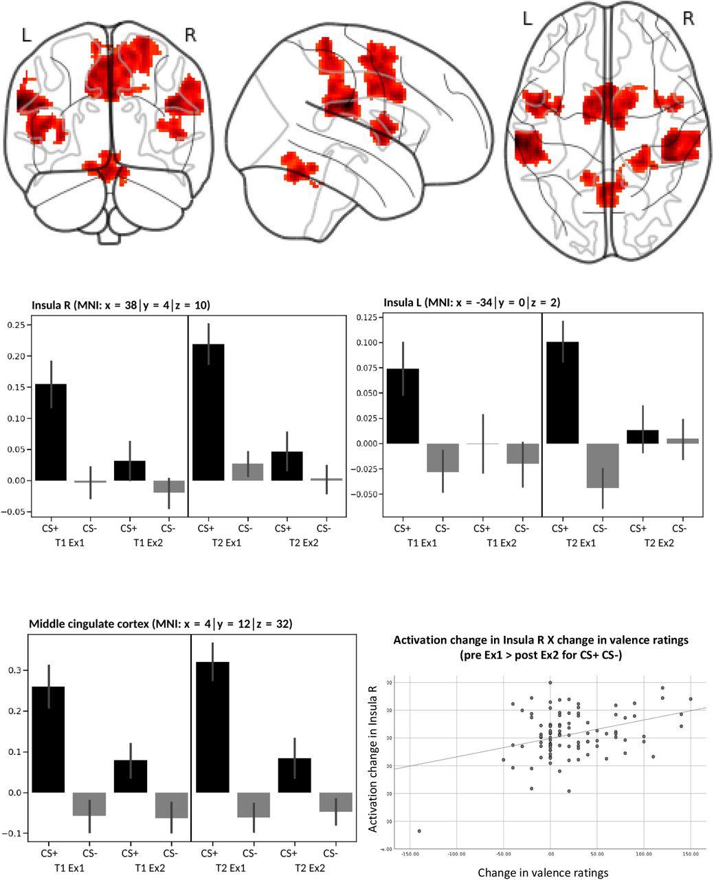 Neural Adaptation Of Cingulate And Insular Activity During Delayed Fear Extinction A Replicable Pattern Across Assessment Sites And Repeated Measurements Medrxiv