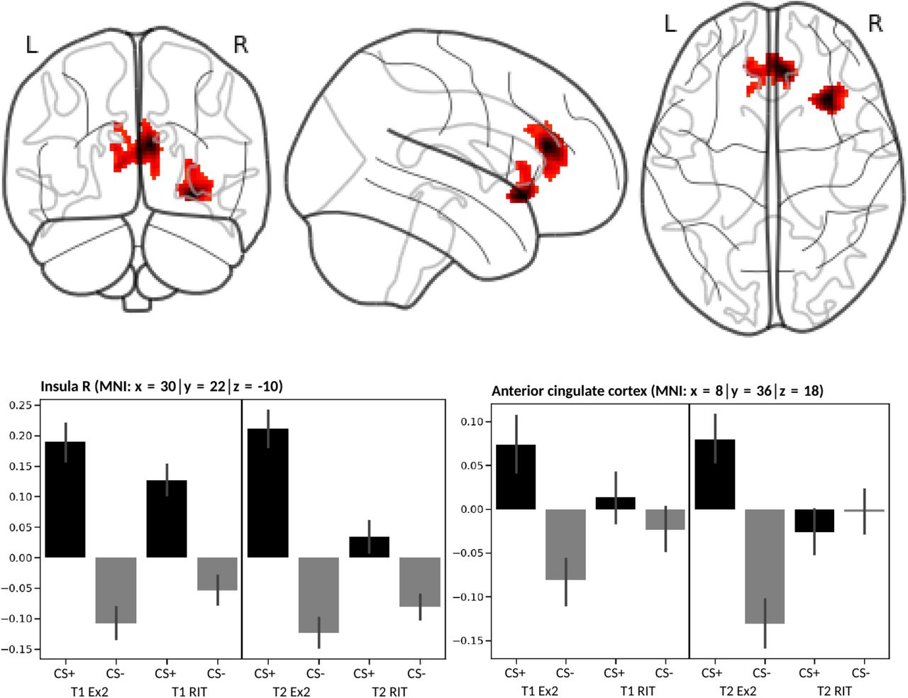 Neural Adaptation Of Cingulate And Insular Activity During Delayed Fear Extinction A Replicable Pattern Across Assessment Sites And Repeated Measurements Medrxiv