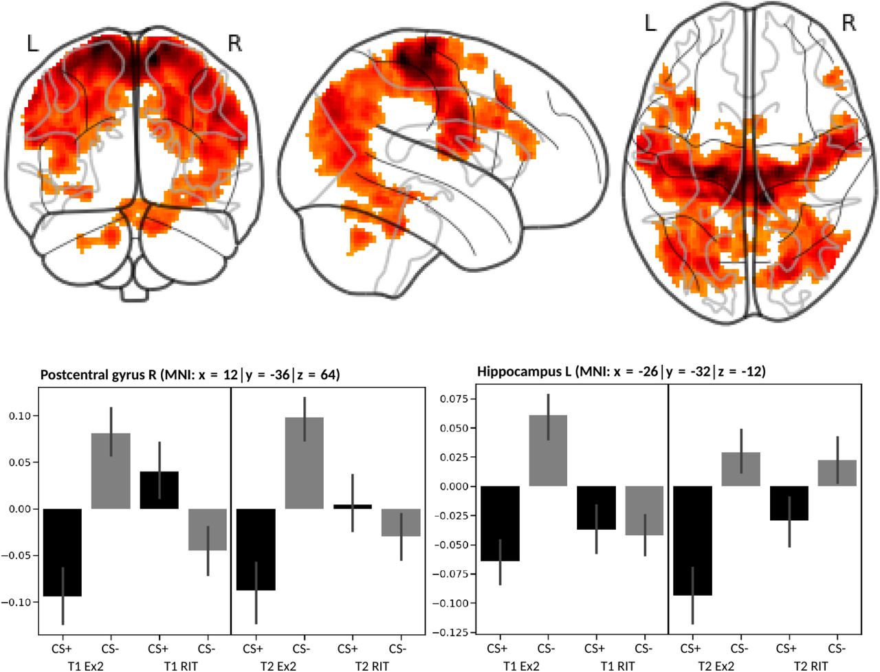 Neural Adaptation Of Cingulate And Insular Activity During Delayed Fear Extinction A Replicable Pattern Across Assessment Sites And Repeated Measurements Medrxiv