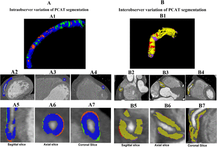 Figure 2A: