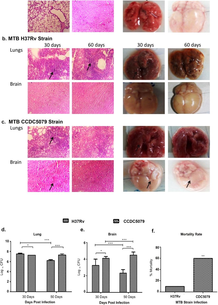 Variation In Mycobacterium Tuberculosis Genotype And Molecular Phenotype Influence Clinical Phenotype Of Pulmonary Tuberculosis And Tuberculous Meningitis Infection In Host Medrxiv