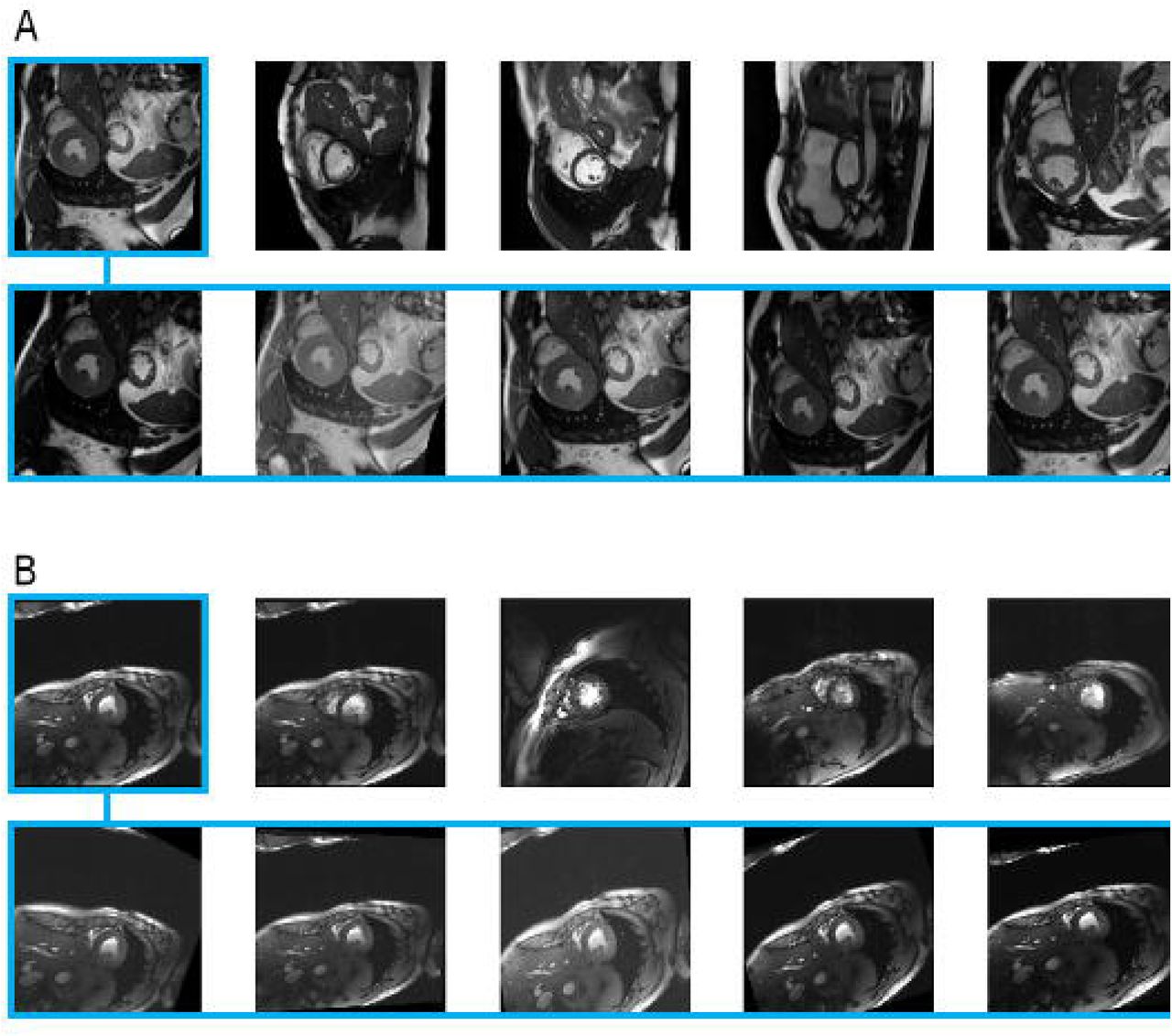 Deep Learning Based Cardiac Cine Segmentation Transfer Learning Application To 7t Ultrahigh 1465