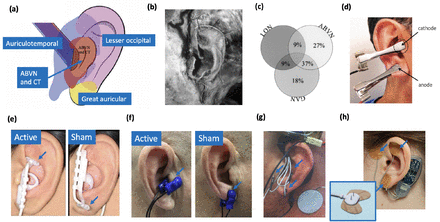 Figure 1: