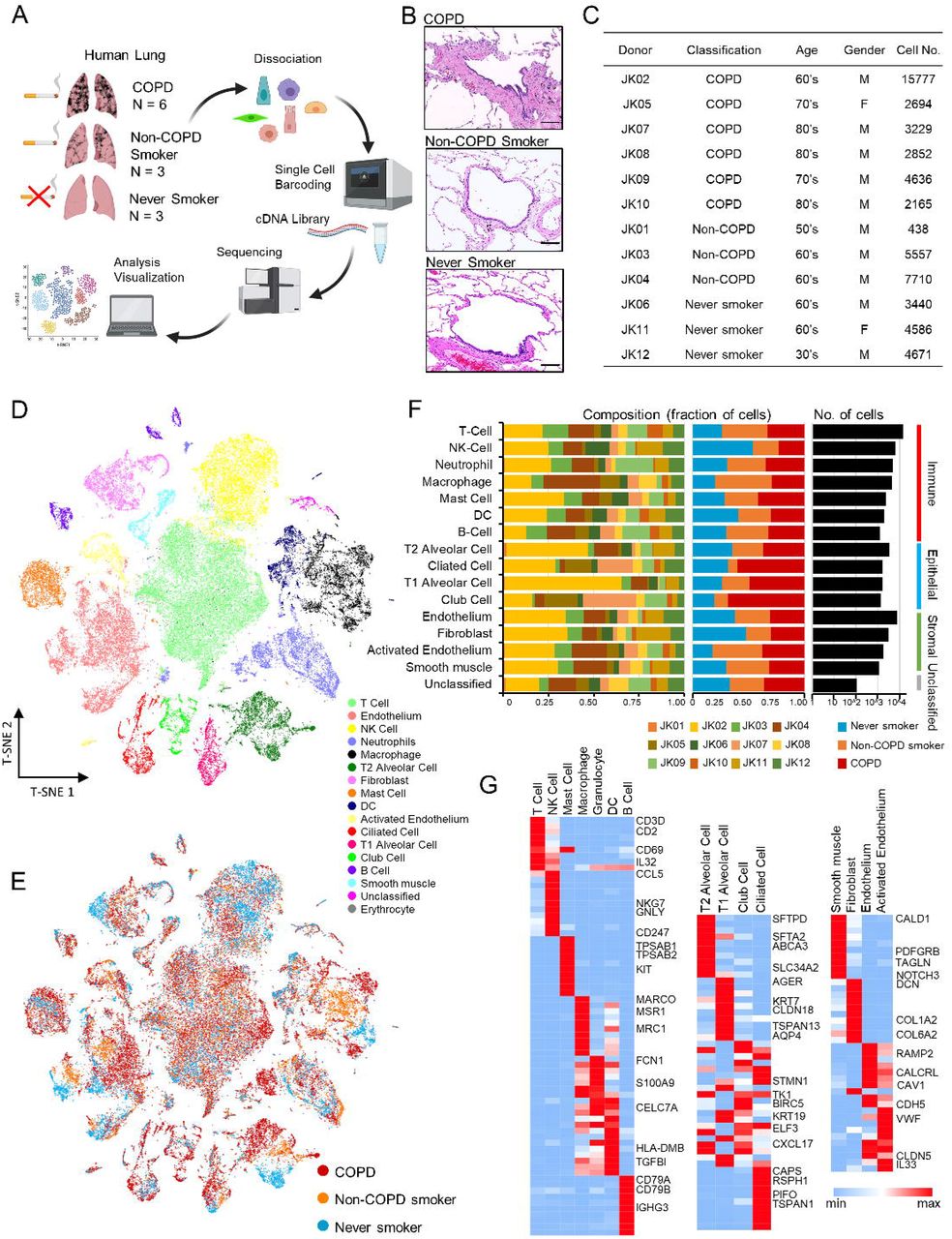 Single-cell Transcriptome Analysis Reveals An Anomalous Epithelial ...