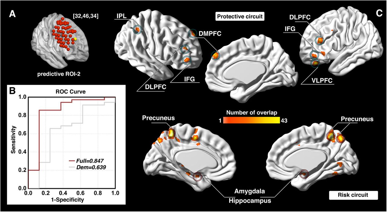 Full article: Anxiolytic effects of theaflavins via dopaminergic activation  in the frontal cortex