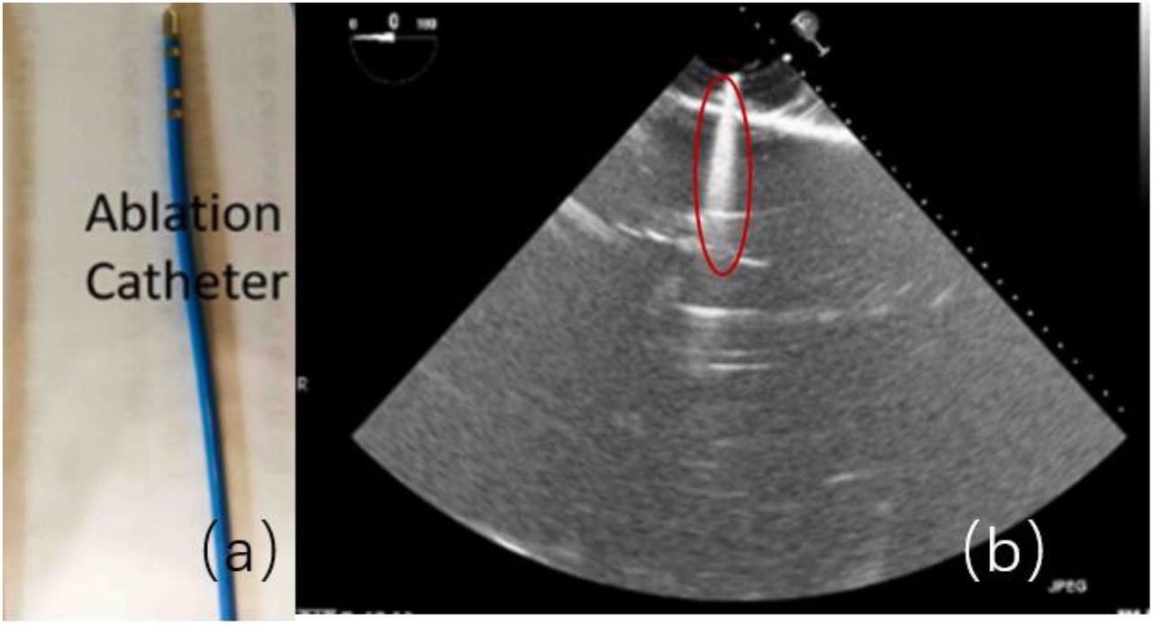 Virtual TEE: Standard Views, Cardiac, Transesophageal Echocardiography, 3D  Heart Model, Education