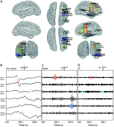 Figure 1: