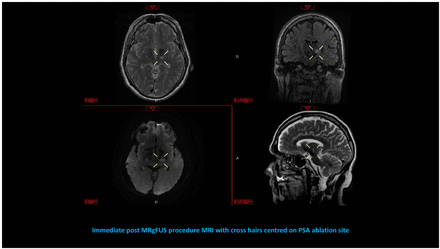 Figure 1: