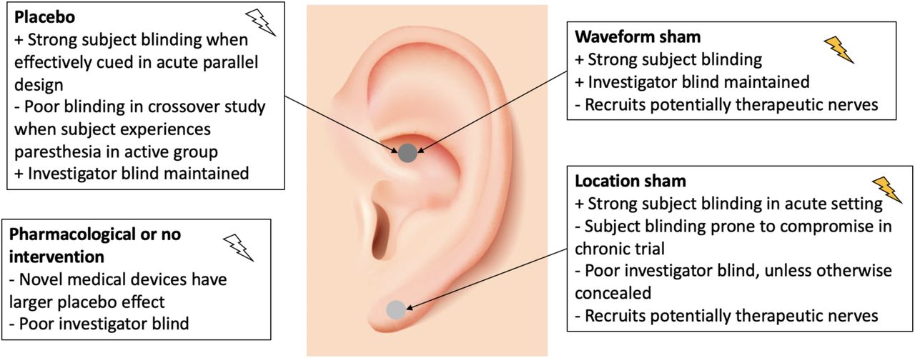 Transcutaneous auricular vagus nerve stimulation as a potential