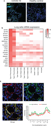 Fig 2: