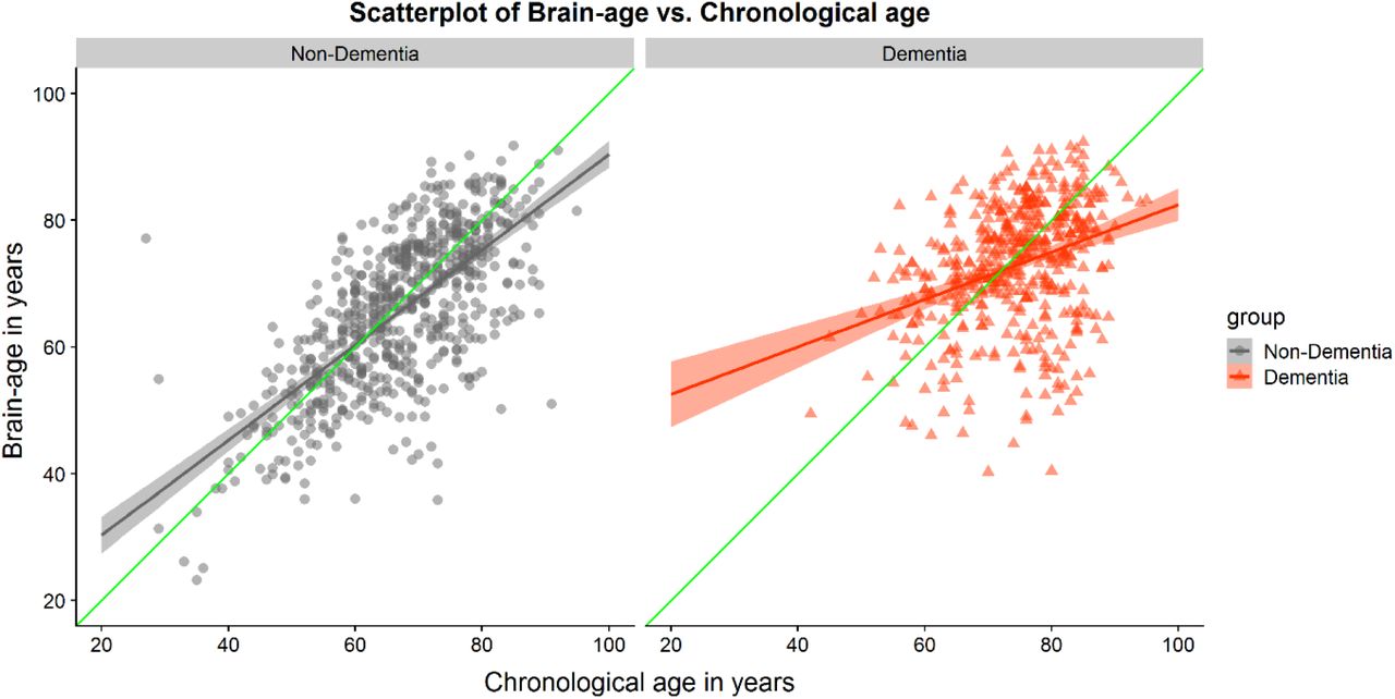 Brain age' screening for dementia
