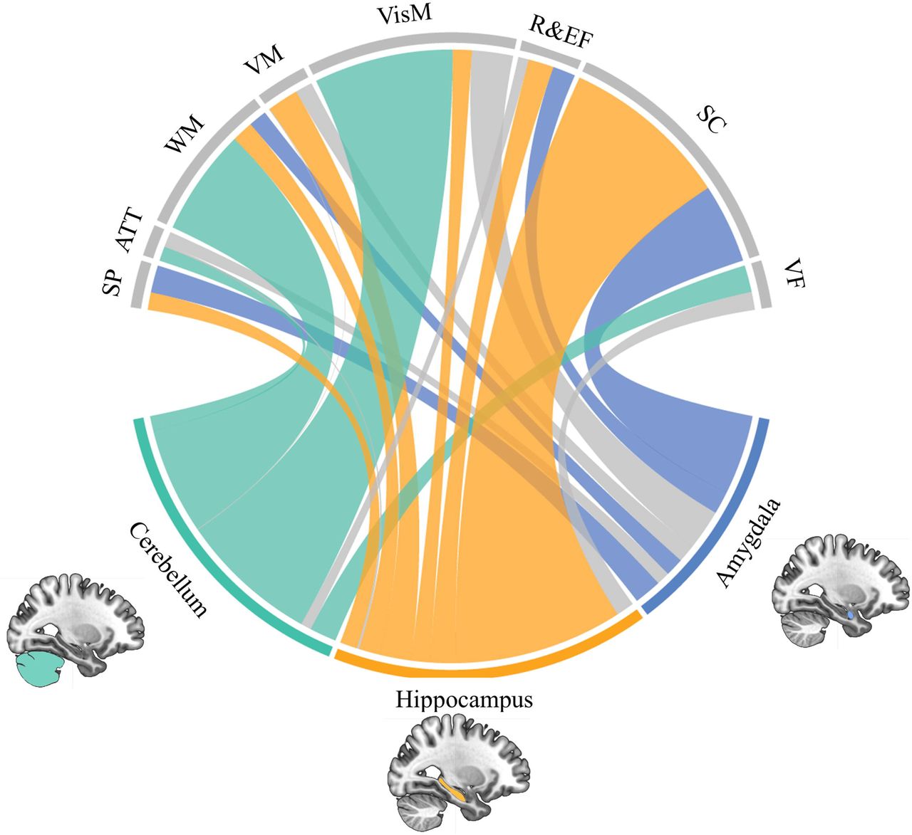 Large-scale analysis of structural brain asymmetries in schizophrenia via  the ENIGMA consortium