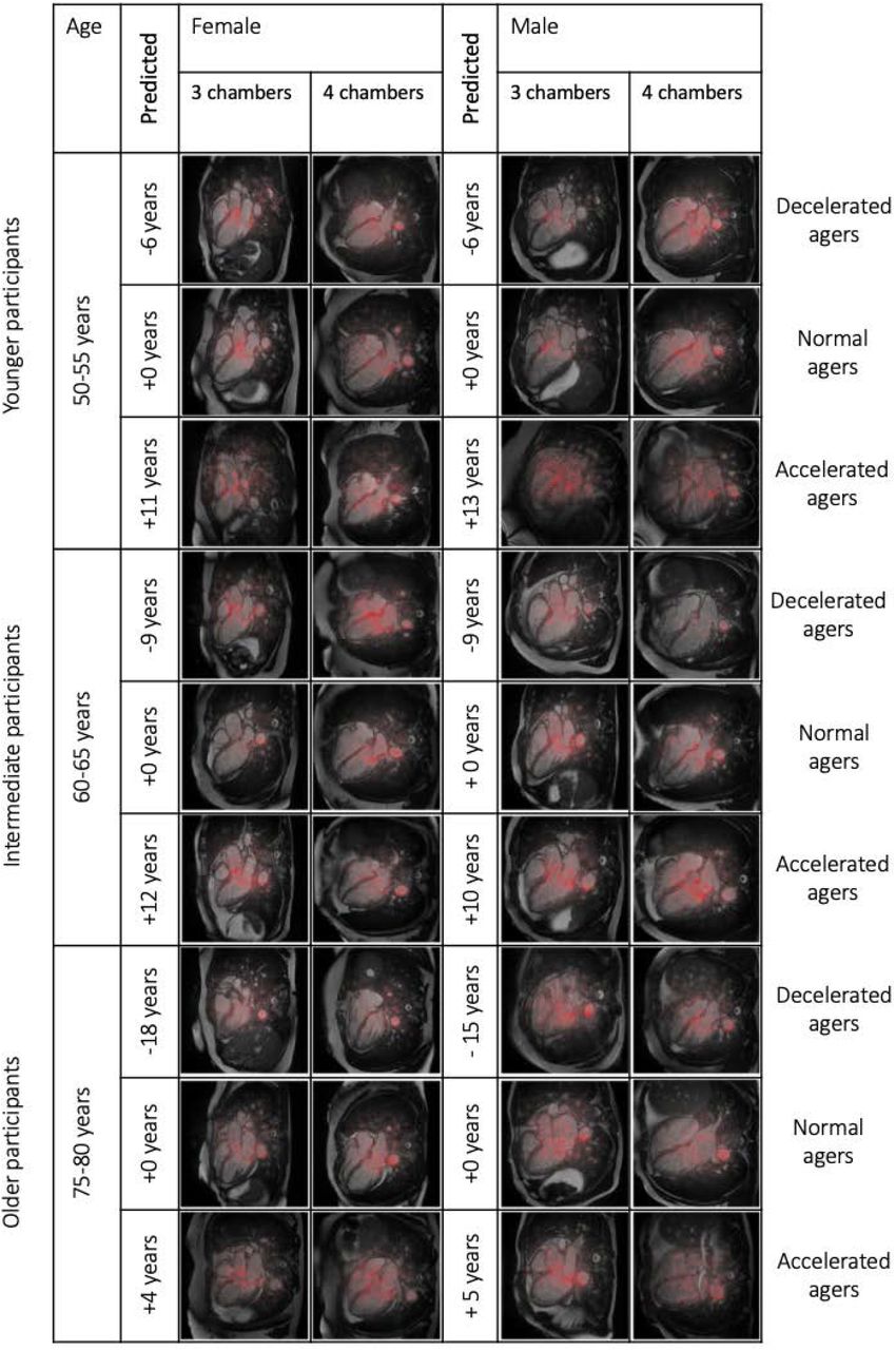 Dissecting heart age using cardiac magnetic resonance videos,  electrocardiograms, biobanks, and deep learning | medRxiv