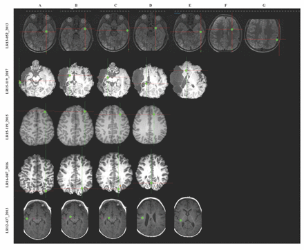 Supplementary Figure 2: